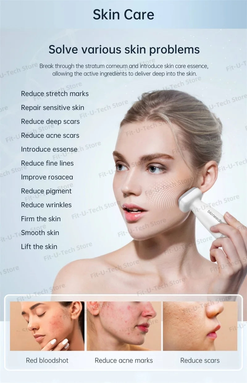 new-adjustable-derma-stamp-microneedle-120-pins-skin-care-beard-growth-scalp-hair-micro-needling-derma.jpg